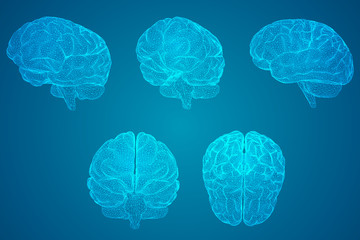 胆机与功放的区别-